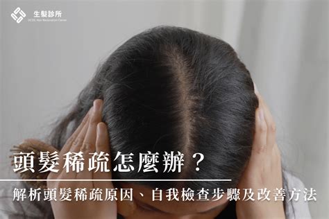 頭髮厚原因|頭髮稀疏怎麼辦？一篇文認識頭髮稀疏原因、症狀、改。